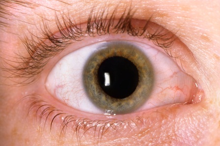 Что такое анемия сетчатки глаза