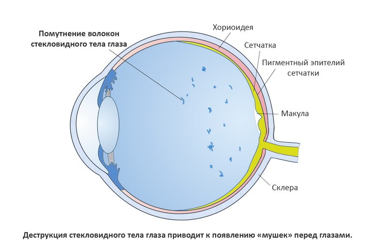 Черные круги перед глазами головокружение