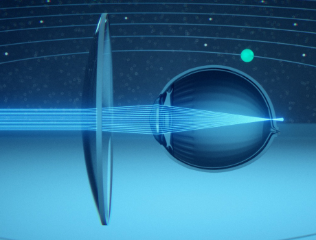 essilor-preimuschestva img