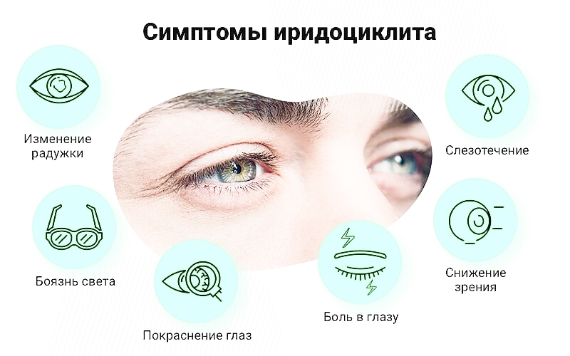 iridociklit-800x500.jpg iridociklit-800x500.jpg