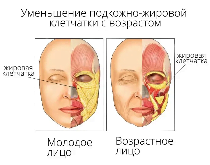 Как убрать отеки под глазами